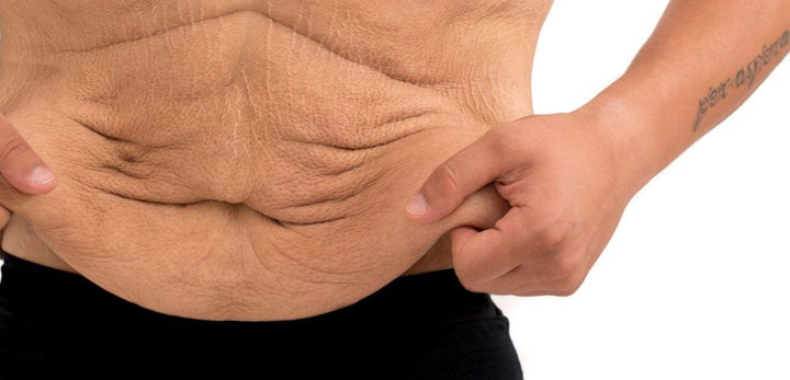 ¿No consigues quemar la grasa abdominal? ¡La abdominoplastia te ayudará! - BOXSR - rutinas de cosmética masculina natural, cuidado personal para hombres